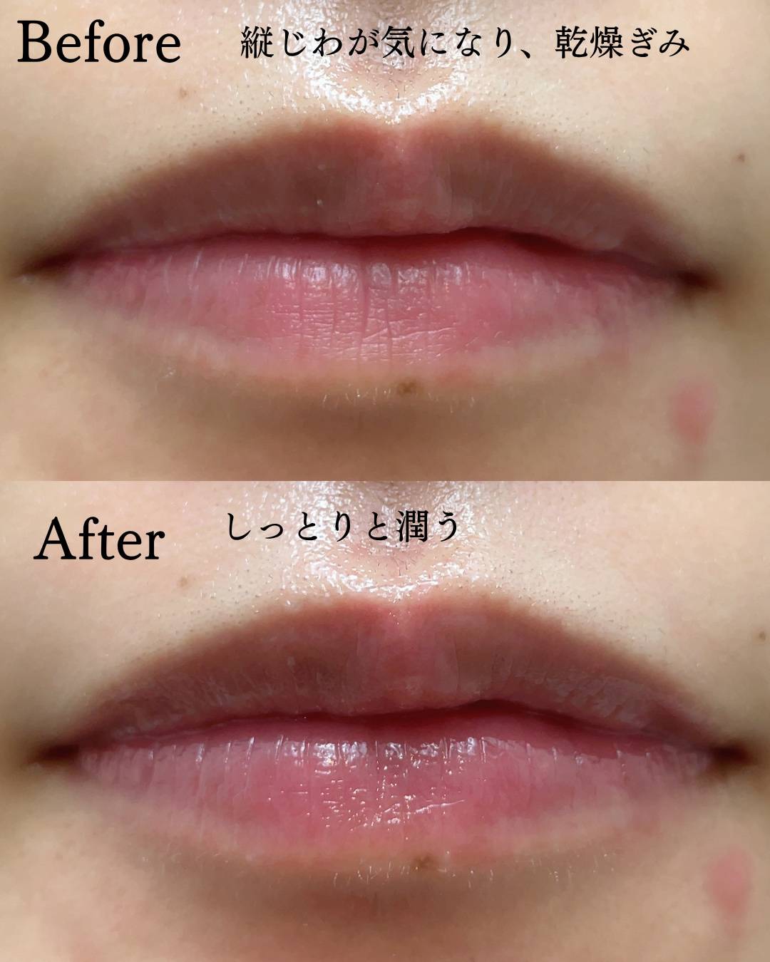 ダーマパワーX リップエッセンス/オバジ/リップ美容液を使ったクチコミ（2枚目）