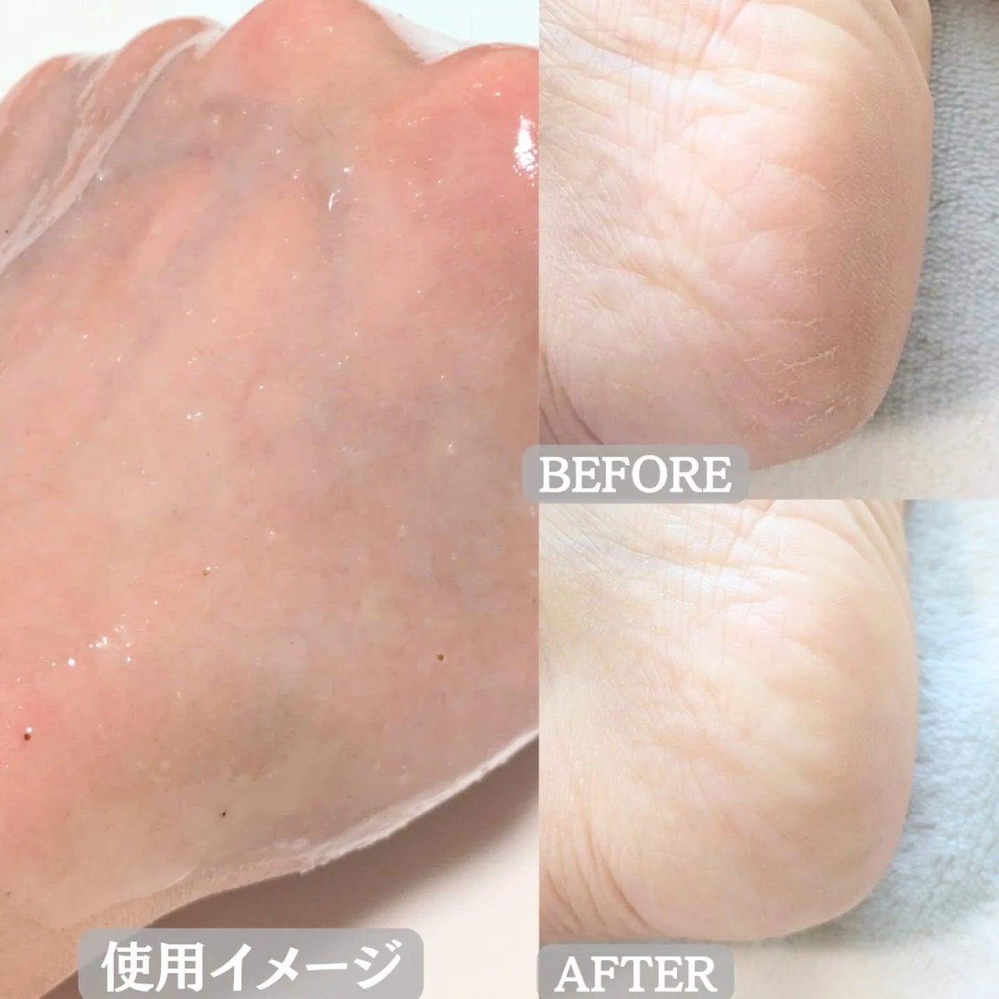 ミチャイコラーゲンスクラブ/MECHAI/ボディスクラブを使ったクチコミ(4枚目)