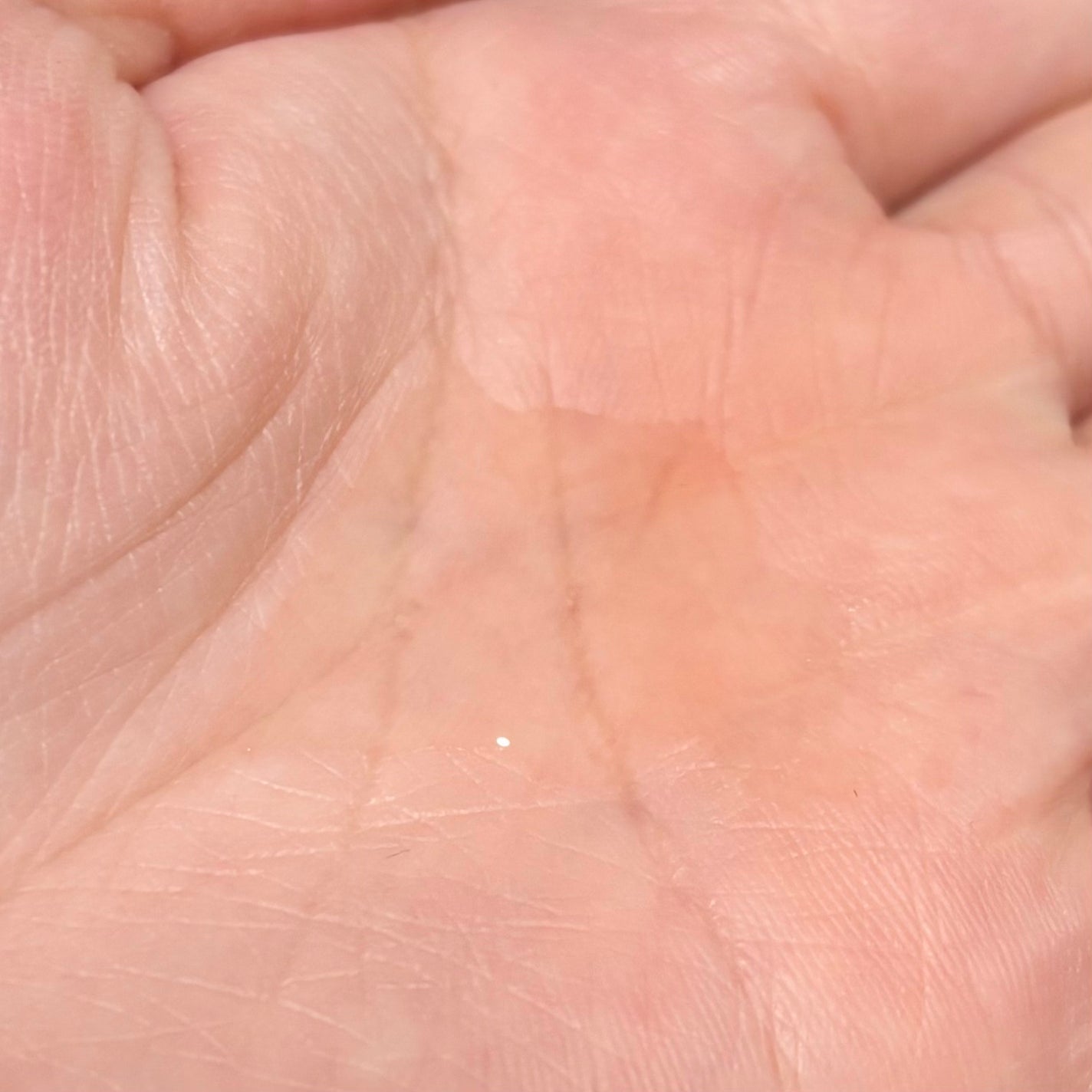 VC100エッセンスローション EX/ドクターシーラボⓇ/化粧水を使ったクチコミ(2枚目)