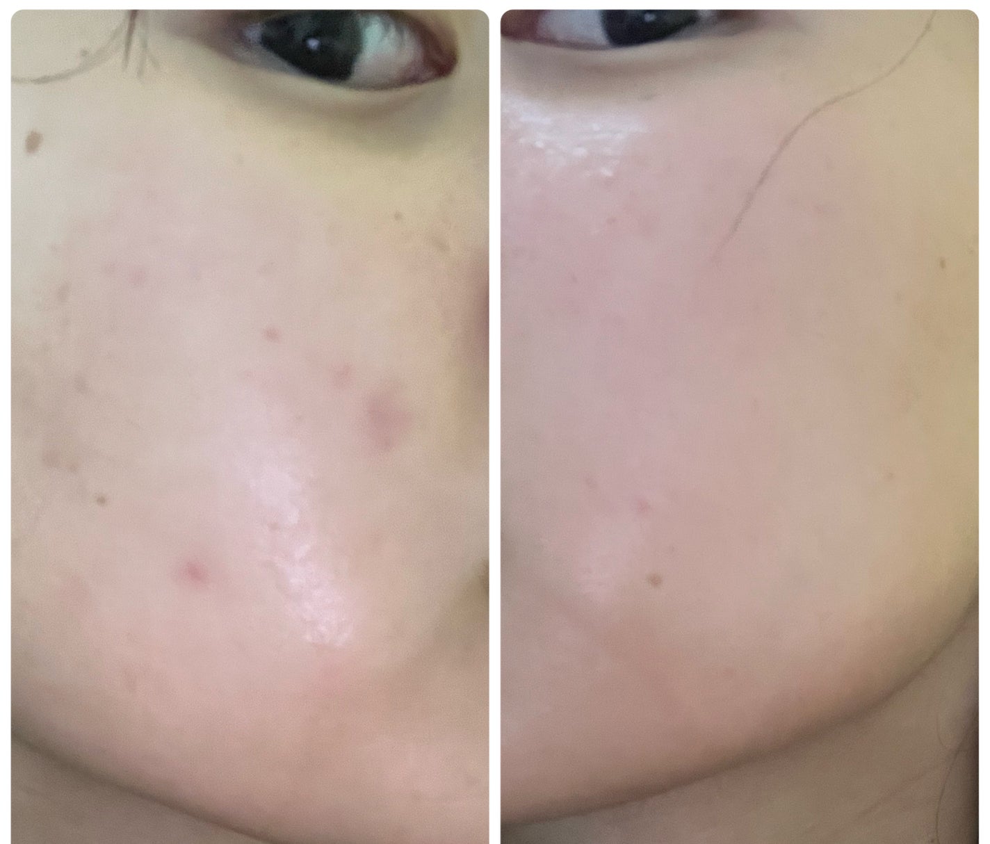 ぽむ on LIPS 「1枚目 2025.10.28エピデュオ 776日目2枚目 20..」(4枚目)