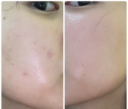 ぽむ on LIPS 「1枚目 2025.10.28エピデュオ 776日目2枚目 20..」(4枚目)