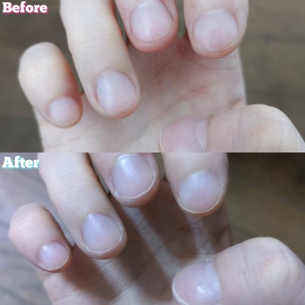 バイタルビューティー スーパーコラーゲン ケラフィット/VITALBEAUTIE/美容ドリンクを使ったクチコミ(8枚目)