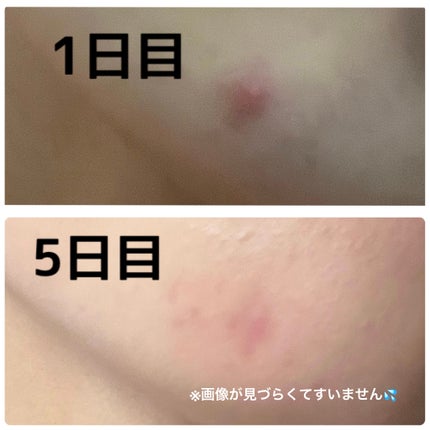 ポア ブライトニング シミケアセラム/celimax/美容液を使ったクチコミ(2枚目)