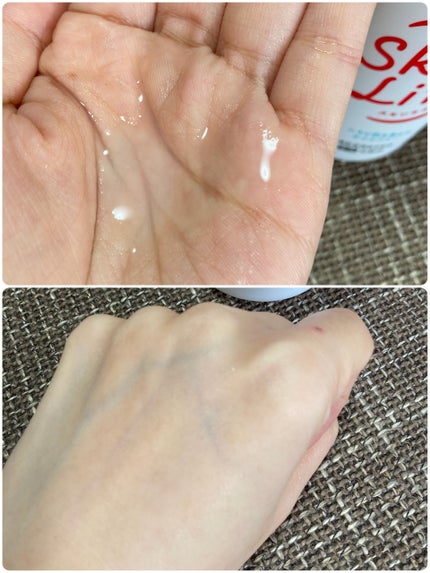 薬用化粧水/スキンライフ/化粧水を使ったクチコミ(3枚目)