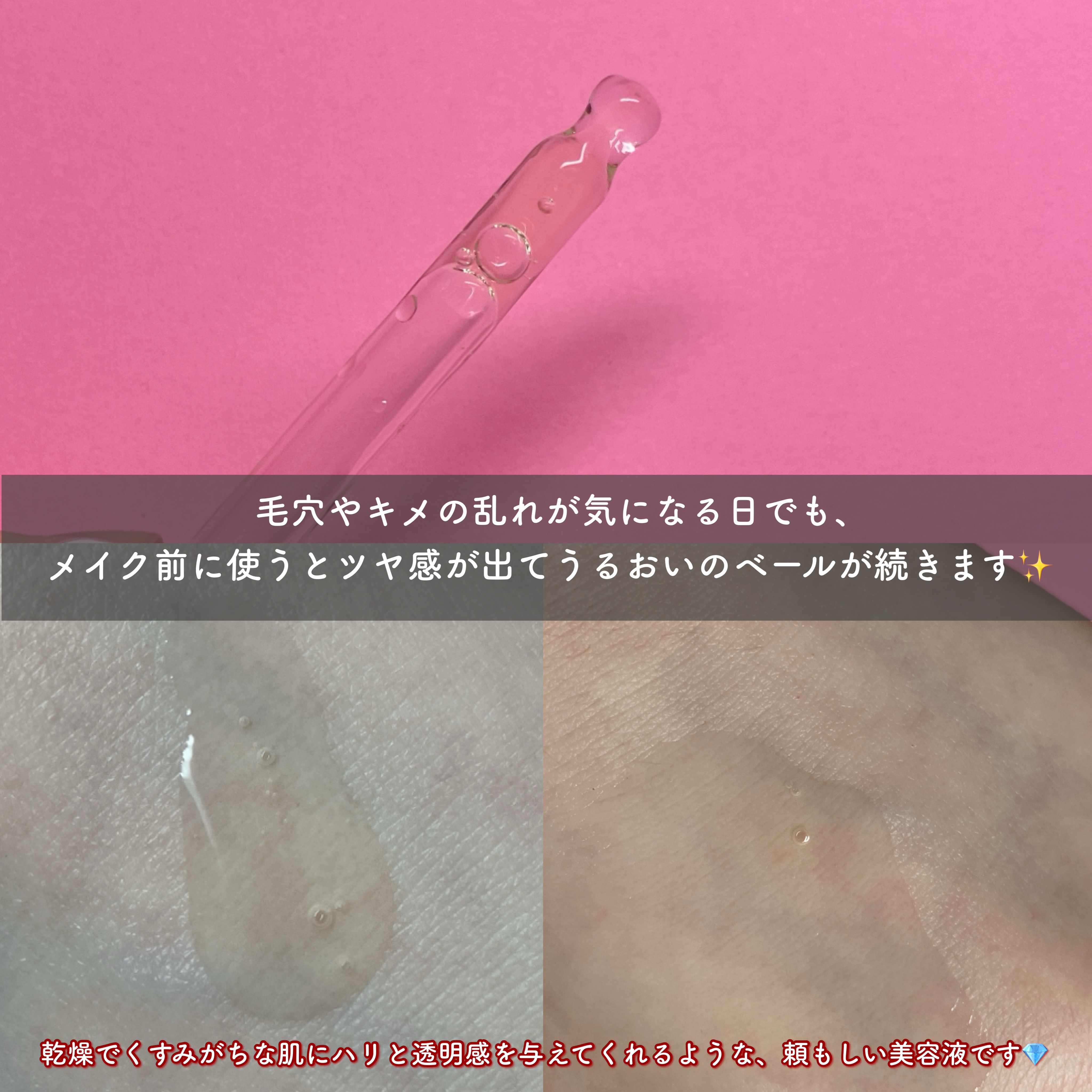 スピテラパーミアPDRNアンプル/NUDIQUE/美容液を使ったクチコミ（3枚目）