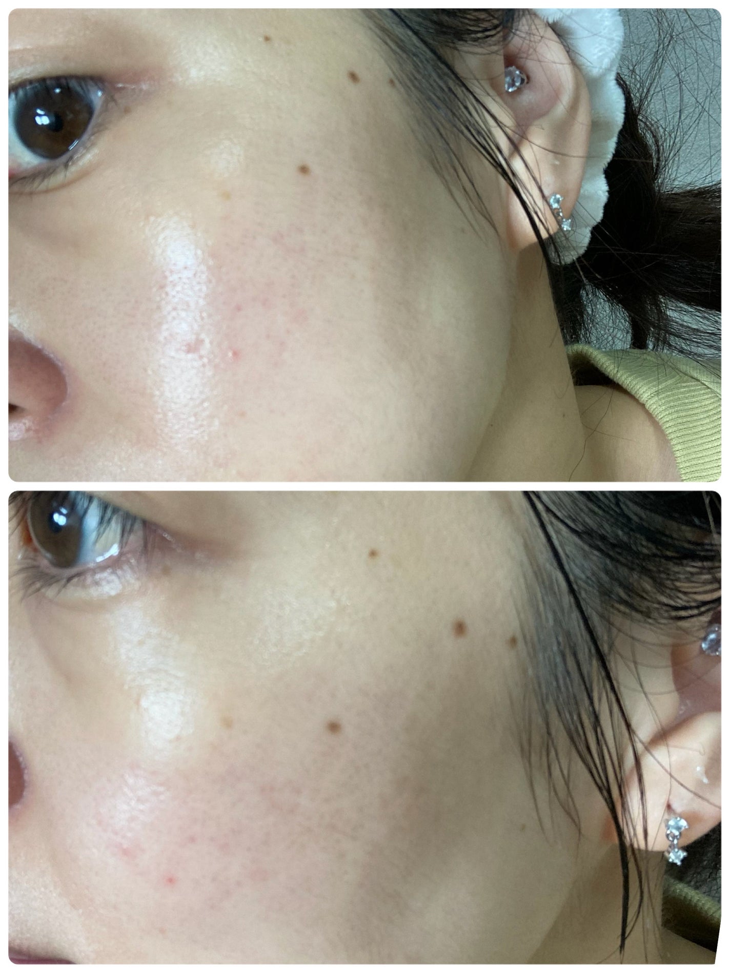 薬用化粧水/スキンライフ/化粧水を使ったクチコミ(4枚目)