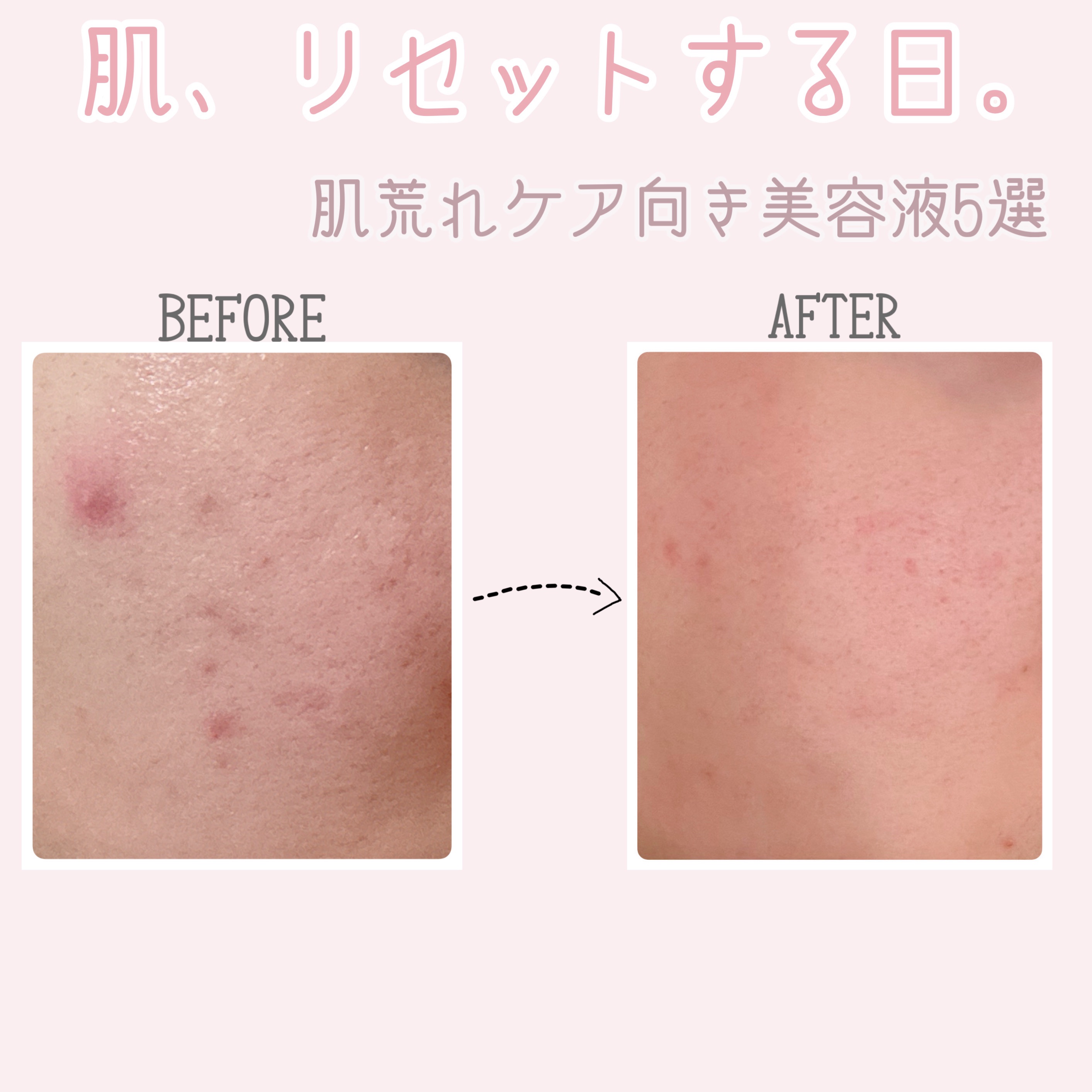 イグニス イオ スムースアップ ピューレ/IGNIS/美容液を使ったクチコミ（1枚目）