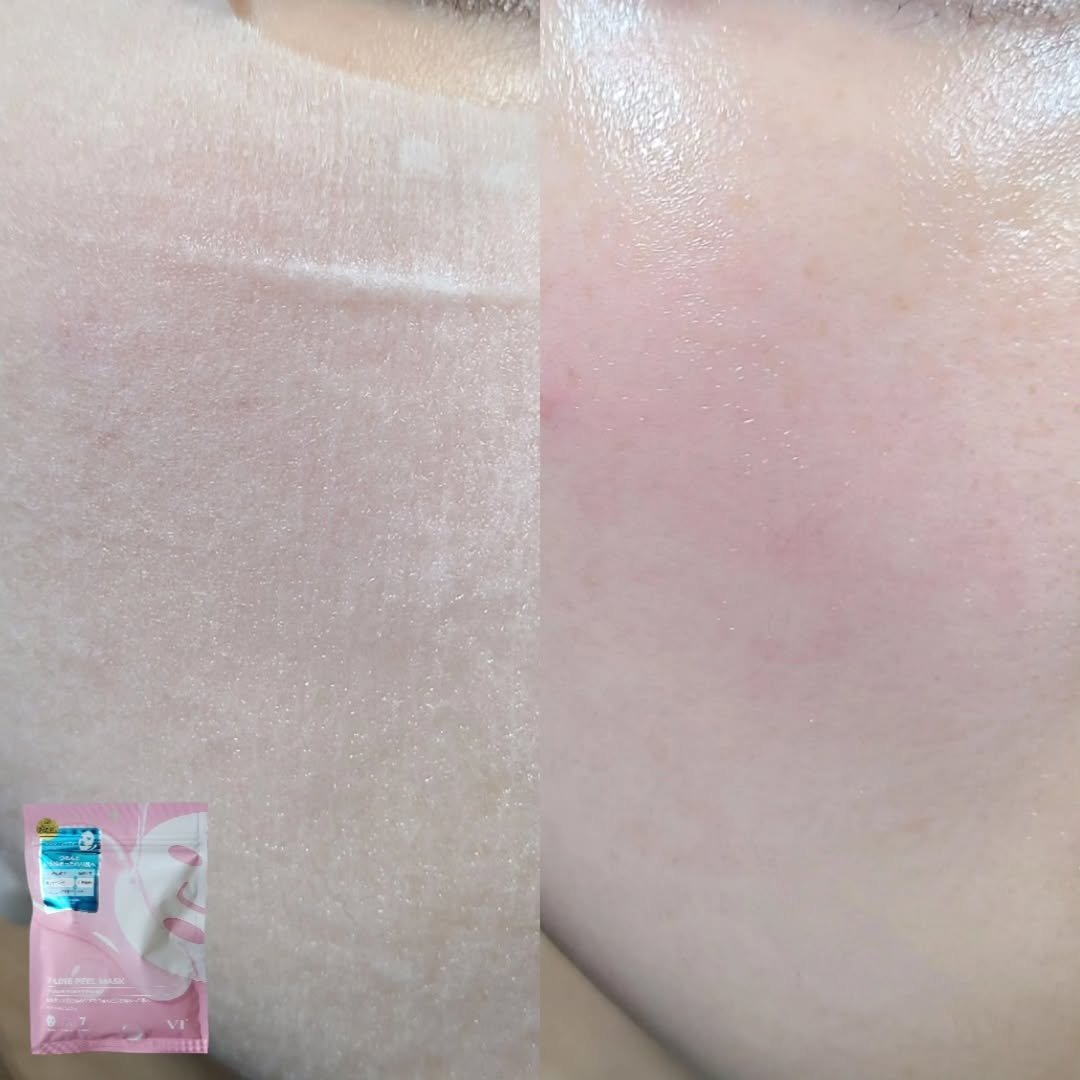WATER PEEL MASK/VT/シートマスク・パックを使ったクチコミ（3枚目）