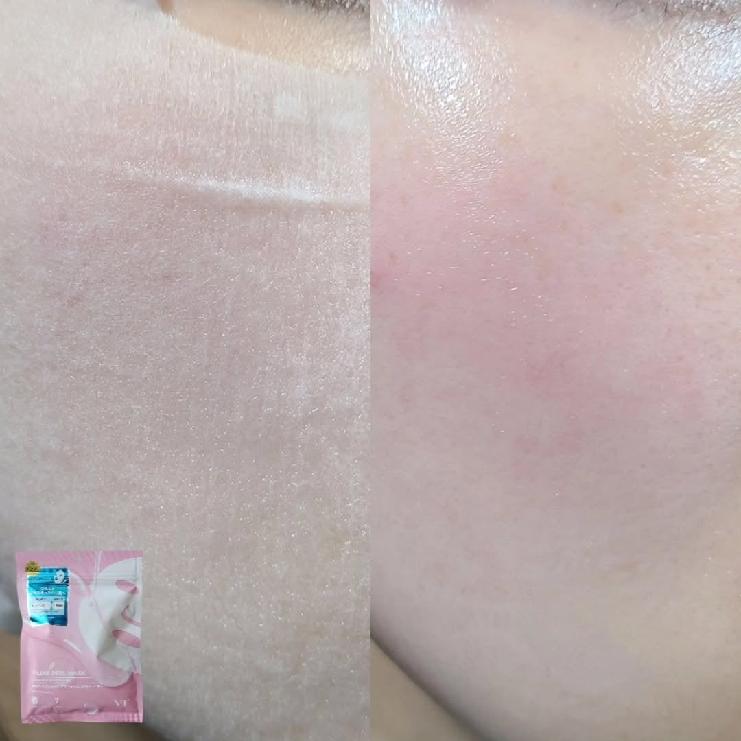 WATER PEEL MASK/VT/シートマスク・パックを使ったクチコミ(3枚目)