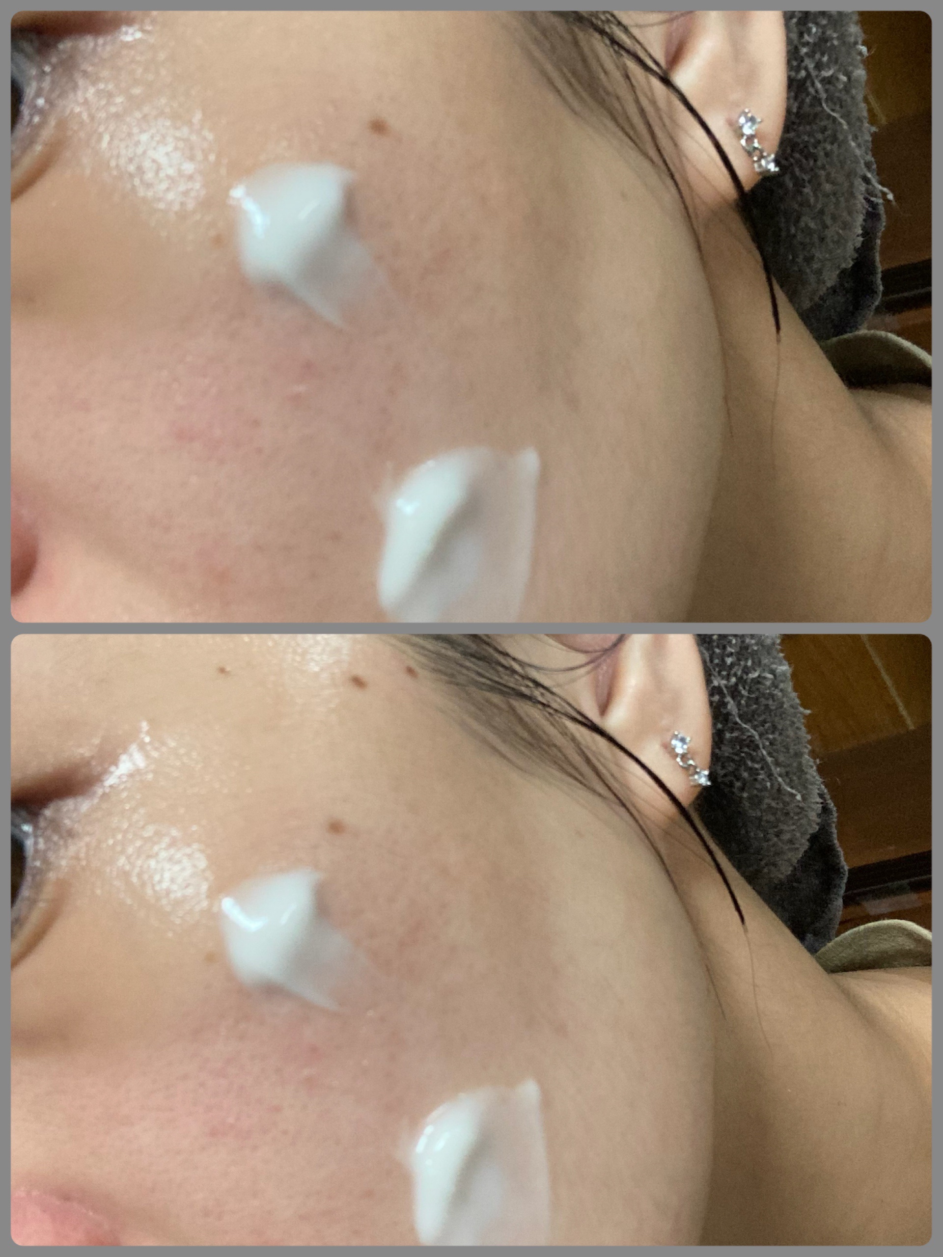 京薬粧 薬用ニードルクリーム/京薬粧/フェイスクリームを使ったクチコミ（3枚目）