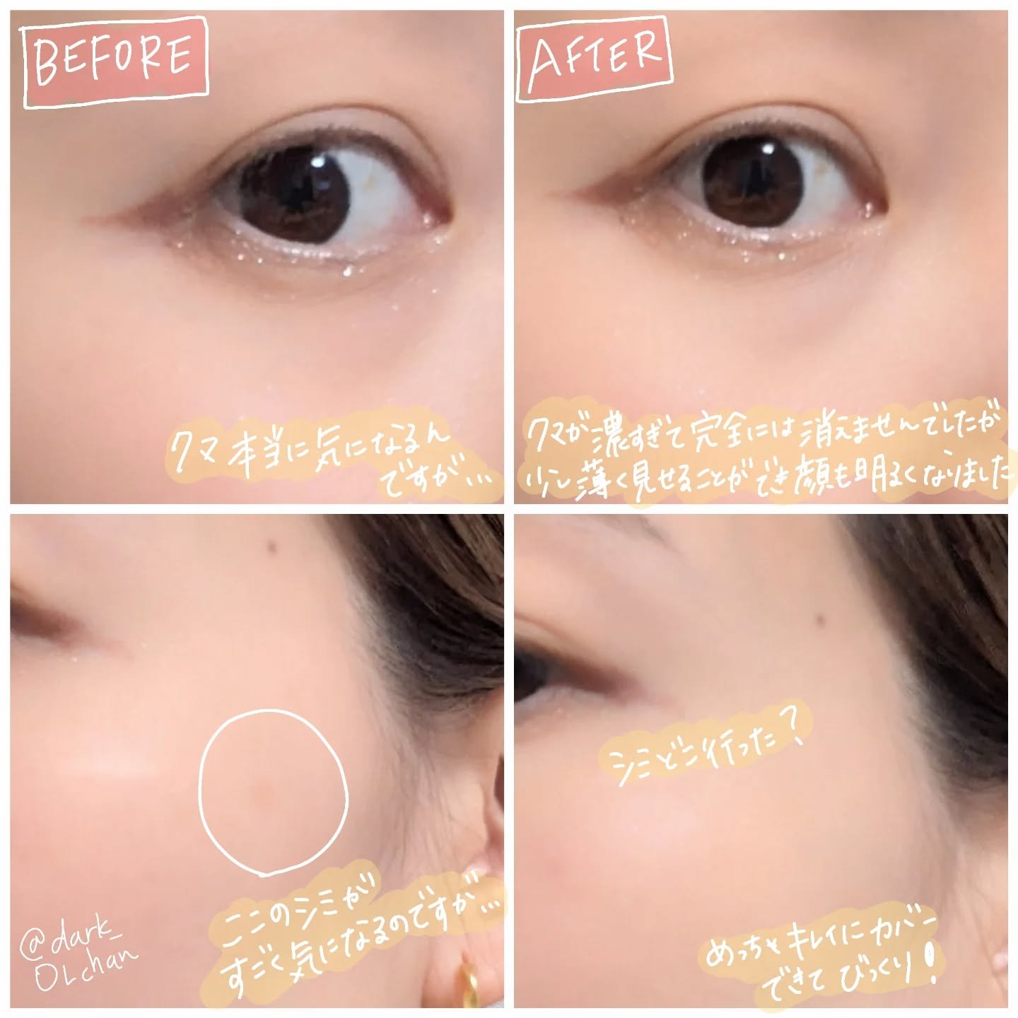 スキンケアコンシーラー/maruthree/リキッドコンシーラーを使ったクチコミ（3枚目）