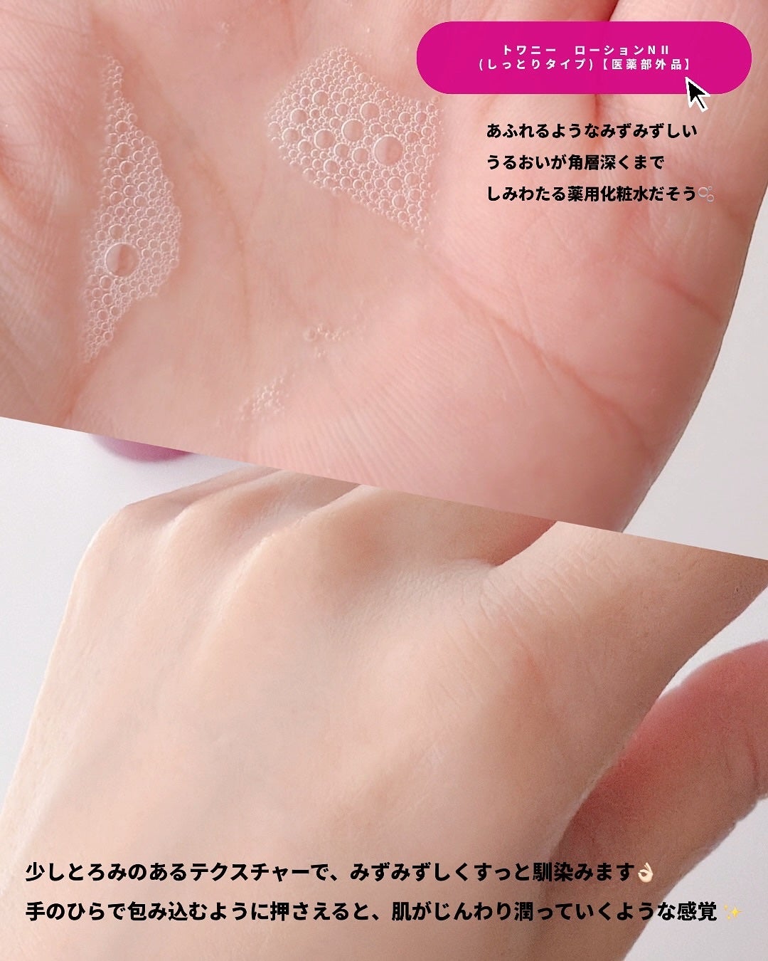 トワニー ローションN II/TWANY/化粧水を使ったクチコミ(3枚目)