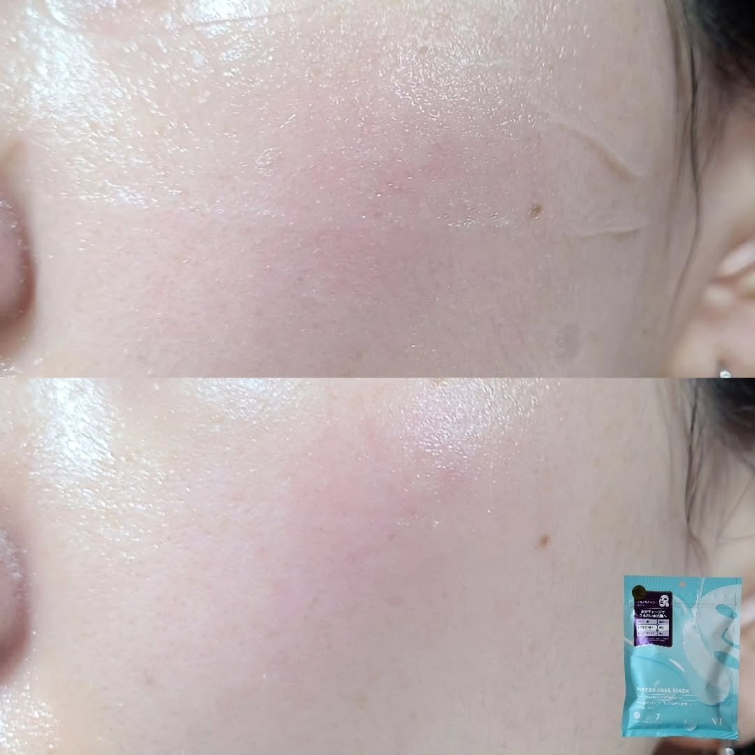 WATER PEEL MASK/VT/シートマスク・パックを使ったクチコミ(5枚目)