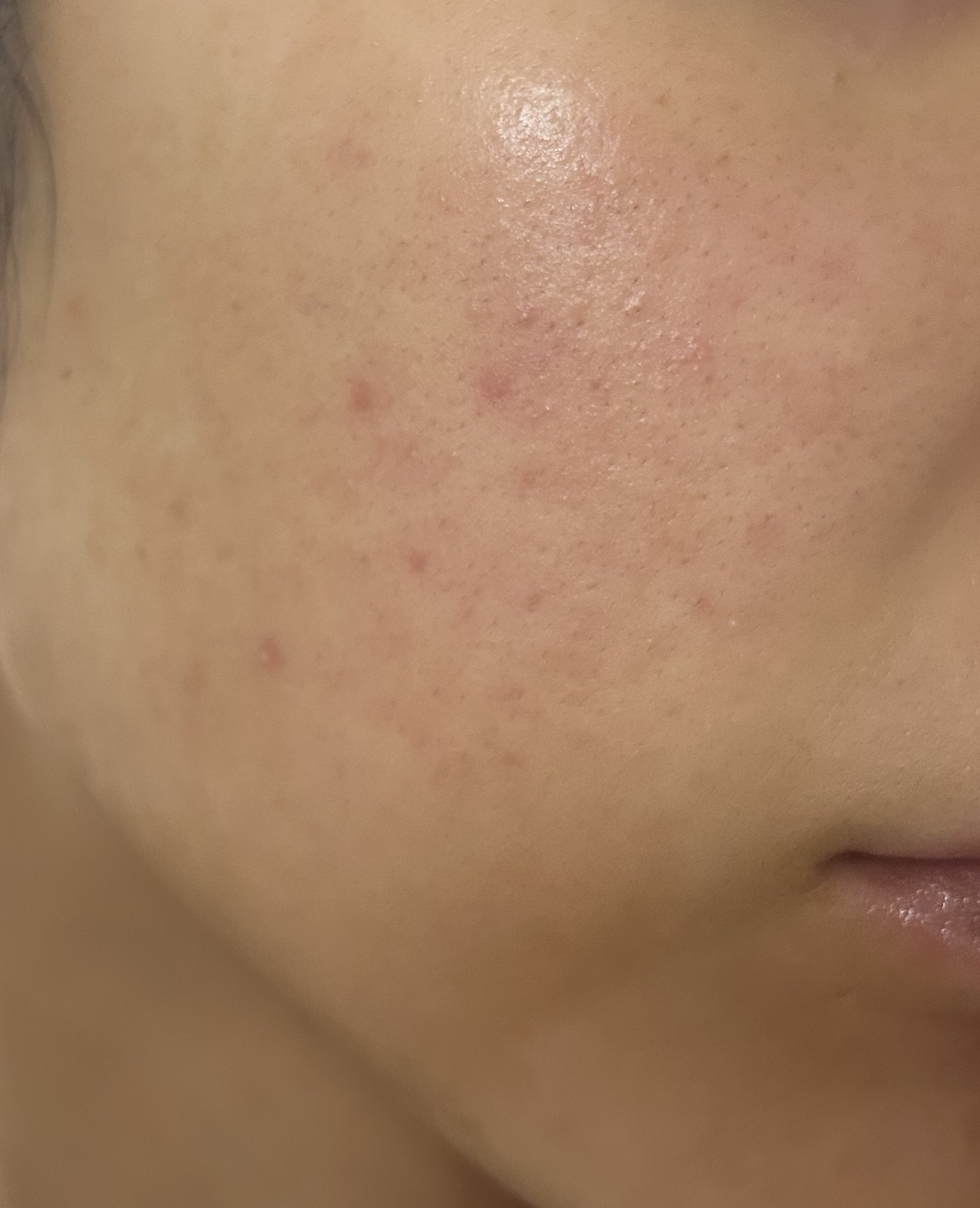 アミノ酸浸透水/Mマークシリーズ/化粧水を使ったクチコミ（1枚目）