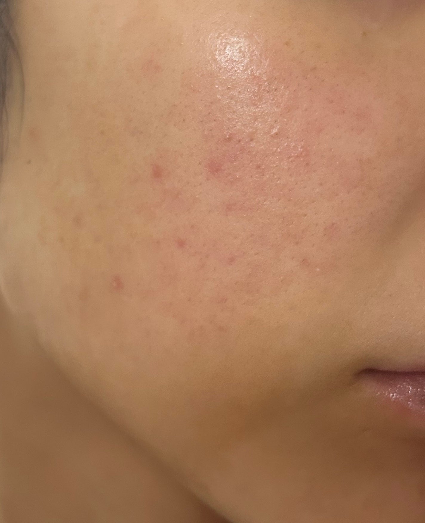 アミノ酸浸透水/Mマークシリーズ/化粧水を使ったクチコミ(1枚目)