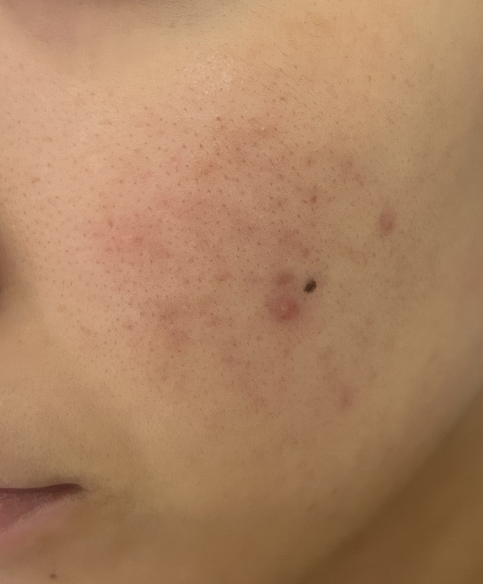 アミノ酸浸透水/Mマークシリーズ/化粧水を使ったクチコミ（2枚目）