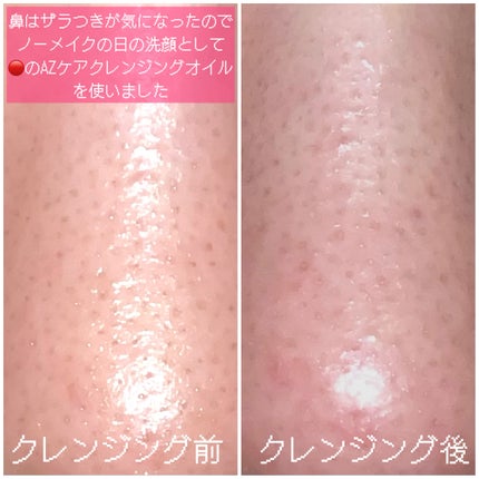 AZケア クレンジングオイル/VT/オイルクレンジングを使ったクチコミ(8枚目)
