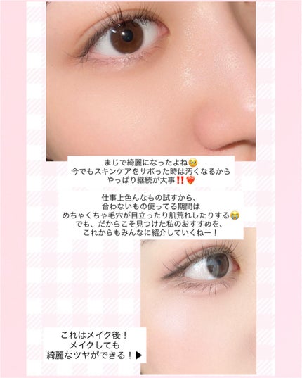 ãŽã£ãŒã¬ã³ãªããœãŒã ã¬ãããŒã«ã»ã©ã /SKIN&LAB/çŸå®¹æ¶²ã䜿ã£ãã¯ãã³ãïŒ3æç®ïŒ