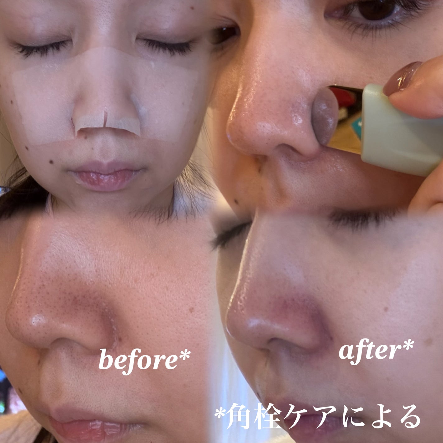 ディープクリーンマスター/ilso/その他スキンケアグッズを使ったクチコミ(4枚目)