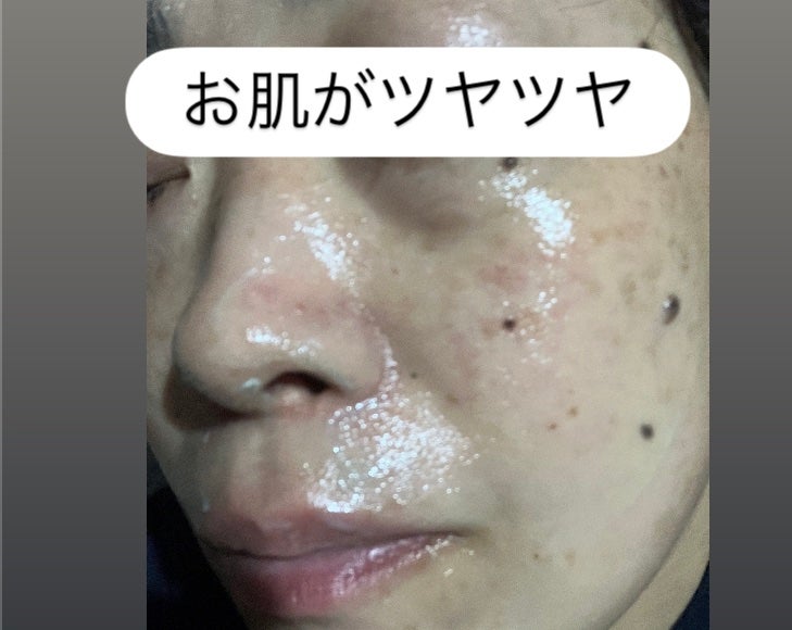 PDRN カプセルクリーム 100/VT/フェイスクリームを使ったクチコミ(4枚目)