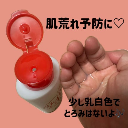 薬用化粧水/スキンライフ/化粧水を使ったクチコミ(2枚目)