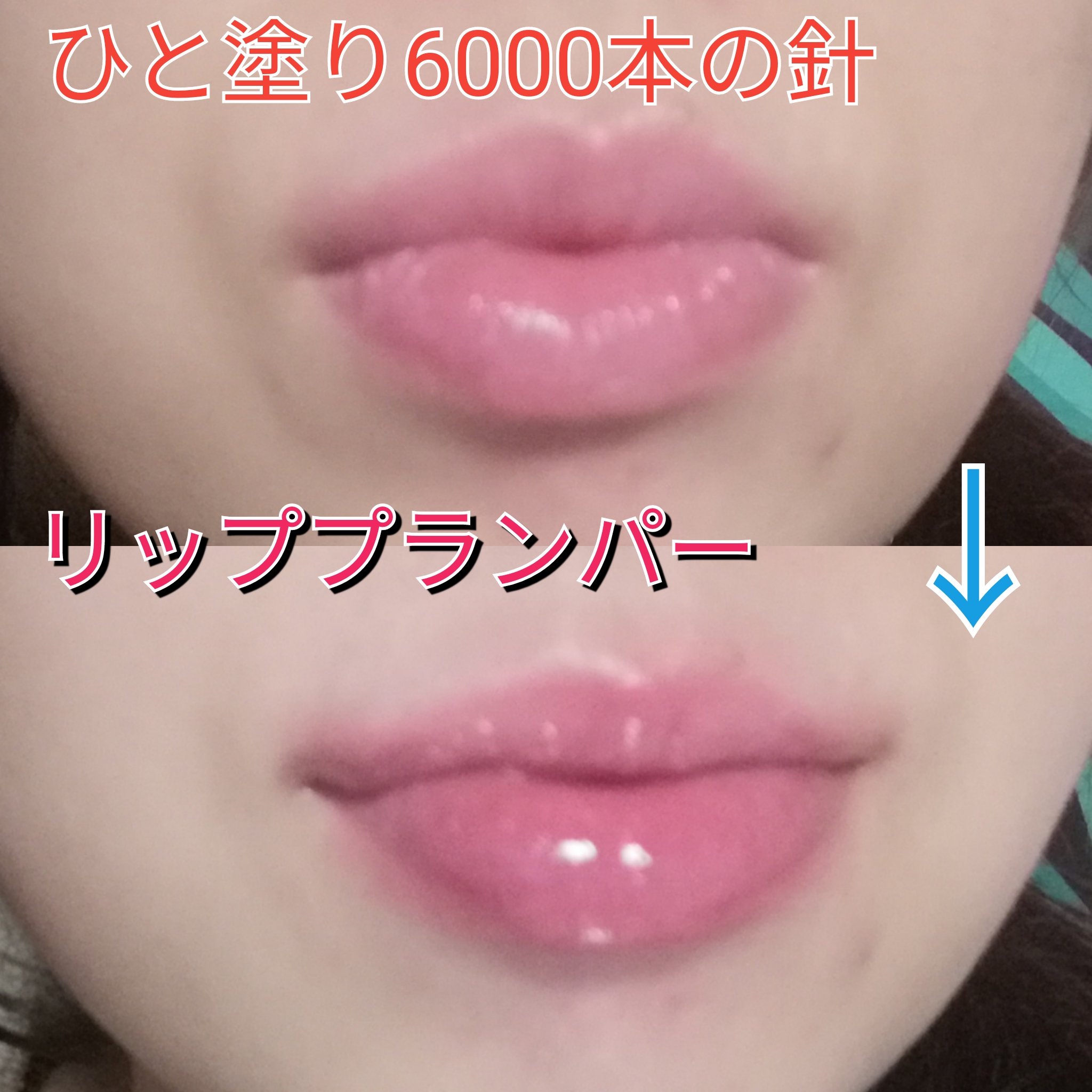 ニードルプランパー  爆弾ストロベリー/Ui2./リッププランパーを使ったクチコミ（1枚目）