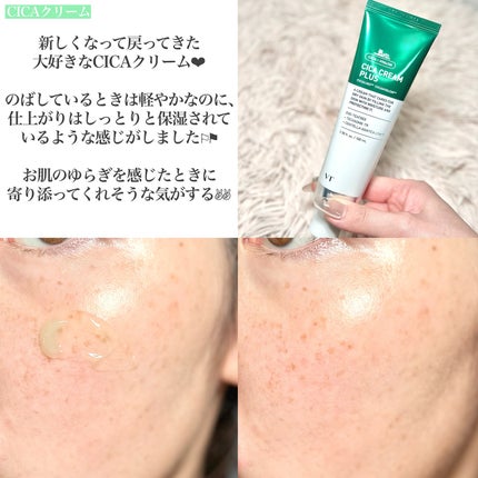 シカレチA クリーム0.05/VT/フェイスクリームを使ったクチコミ(5枚目)