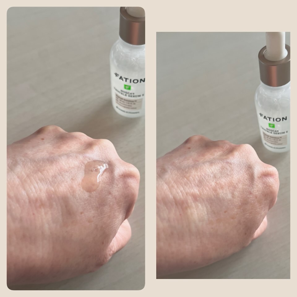 ノスカナイントラブルセラムS/FATION/美容液を使ったクチコミ（3枚目）