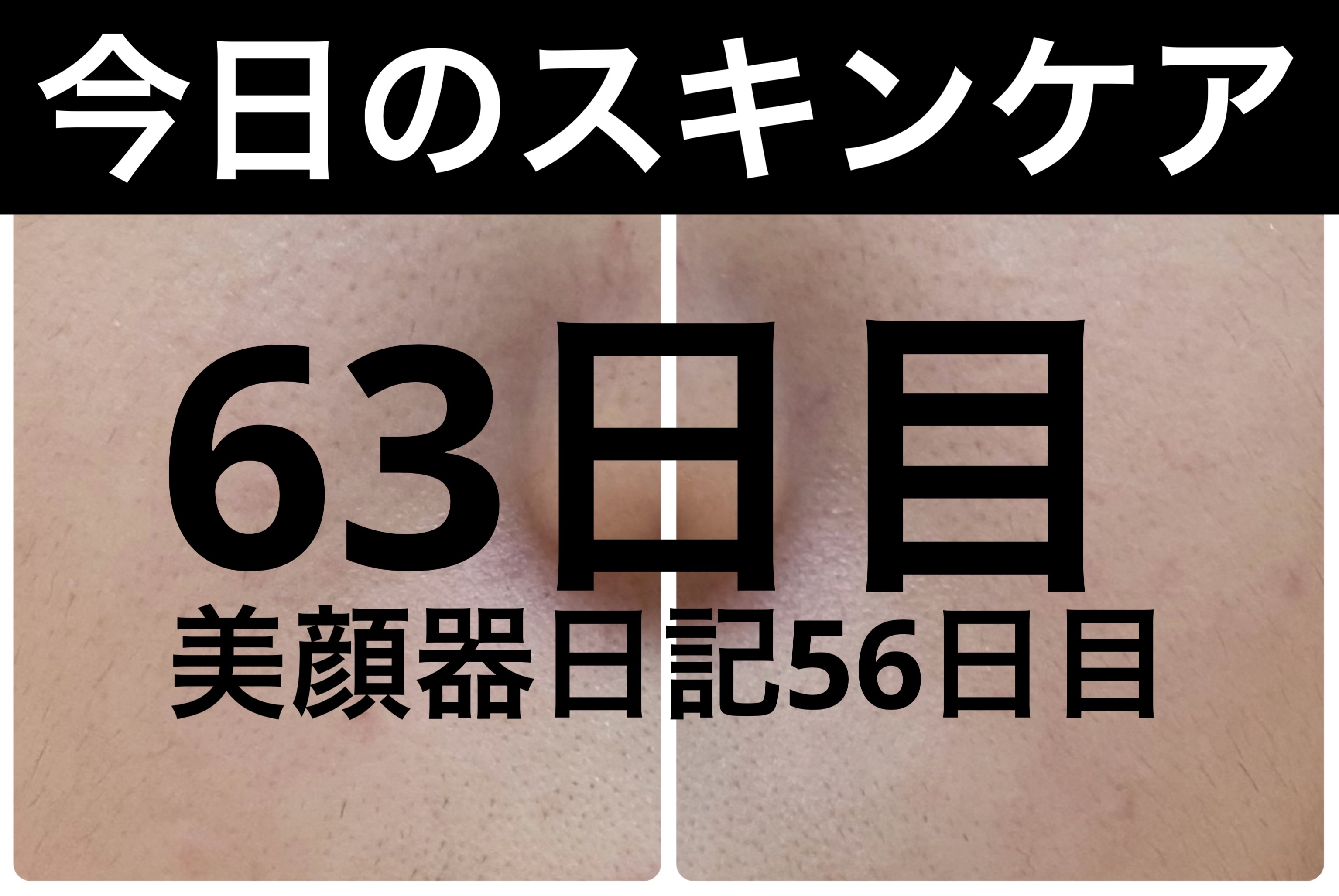 ブラックヘッドバームスクラブ/オブジェ/フェイスバームを使ったクチコミ（1枚目）