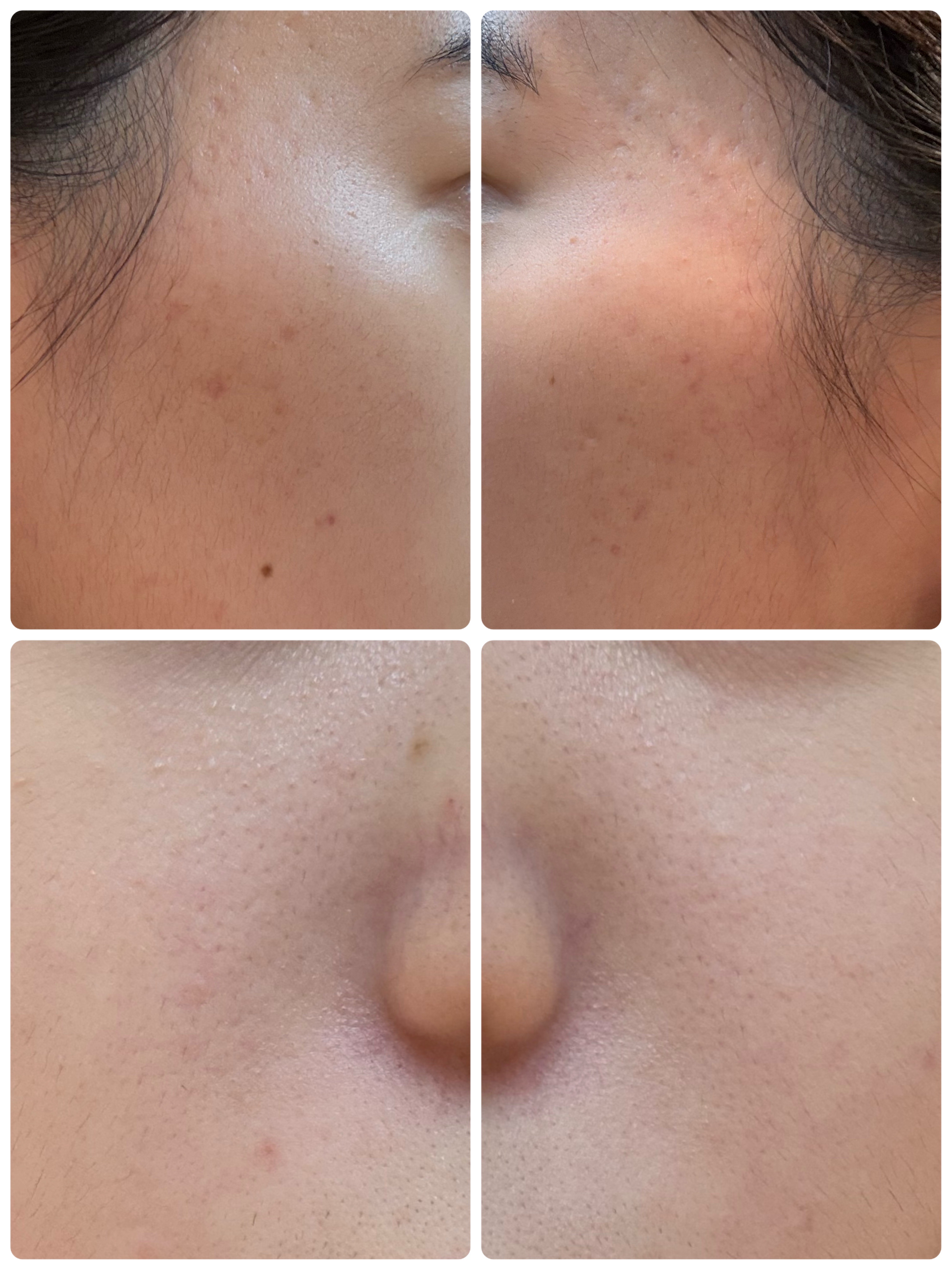 ブラックヘッドバームスクラブ/オブジェ/フェイスバームを使ったクチコミ（2枚目）