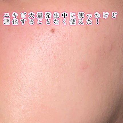 ティーツリーエッセンシャルマスク/MEDIHEAL/シートマスク・パックを使ったクチコミ(2枚目)