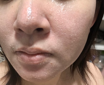 ポアスムージング クレンジングバーム ブラック/CLAYGE/クレンジングバームを使ったクチコミ(5枚目)