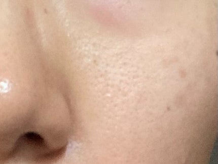 アゼライン酸15 インテンスカーミングセラム/Anua/美容液を使ったクチコミ(3枚目)