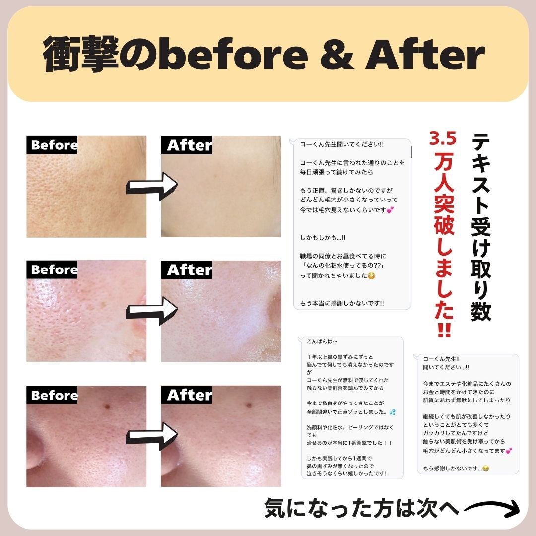 あなたの肌に合ったスキンケア💐コーくん先生 on LIPS 「【9割が知らなう】毛穴に1番効く美容液はコレ🤫..あなたのニキ..」(8枚目)