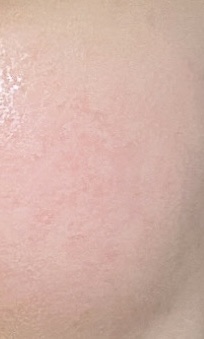 ビタチノールセラム メガショット ゲルマスク 34g/primera/シートマスク・パックを使ったクチコミ（2枚目）