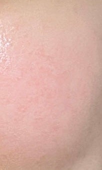 ビタチノールセラム メガショット ゲルマスク/primera/シートマスク・パックを使ったクチコミ(2枚目)