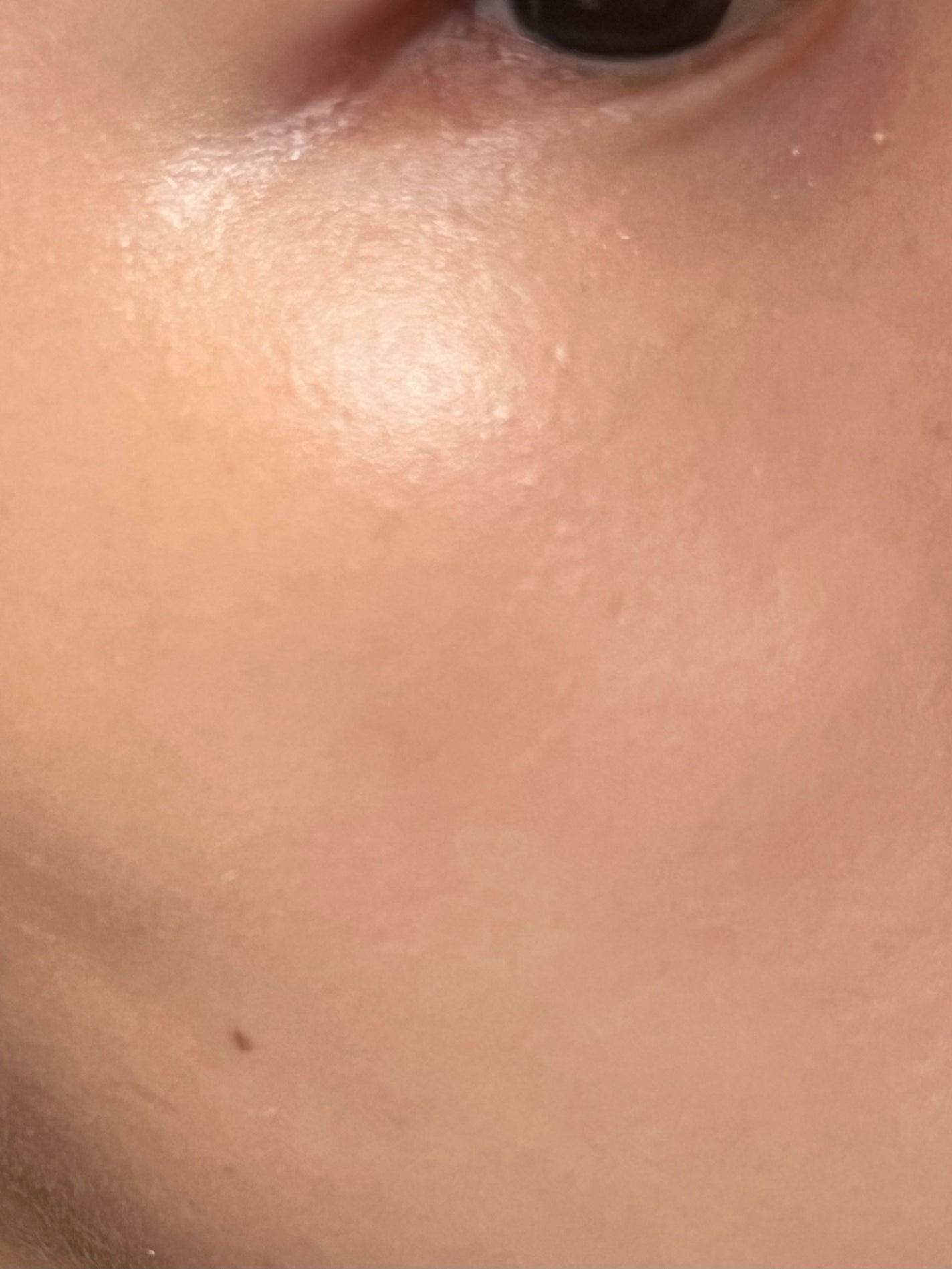 ã±ã€ã ãžã¥ã¬ãªãŒããã¡ã³ããŒã·ã§ã³/KATE/ãªããããã¡ã³ããŒã·ã§ã³ã䜿ã£ãã¯ãã³ãïŒ5æç®ïŒ