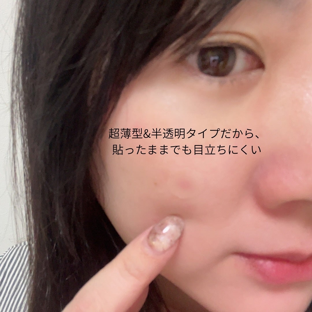 あやこ @フォロバ100 on LIPS 「お風呂上がり、スキンケアする前に気になるところにそっと貼るのが..」(4枚目)