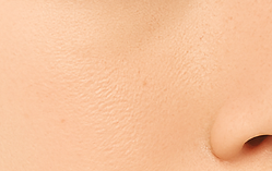 PDRNキューブセラム/DPPR/美容液を使ったクチコミ（2枚目）