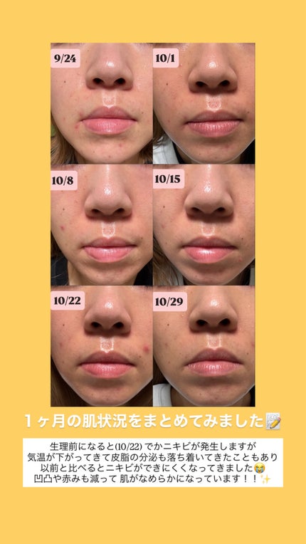 3セラミドパンテノールモイスチャーバリアクリーム/Anua/フェイスクリームを使ったクチコミ(4枚目)