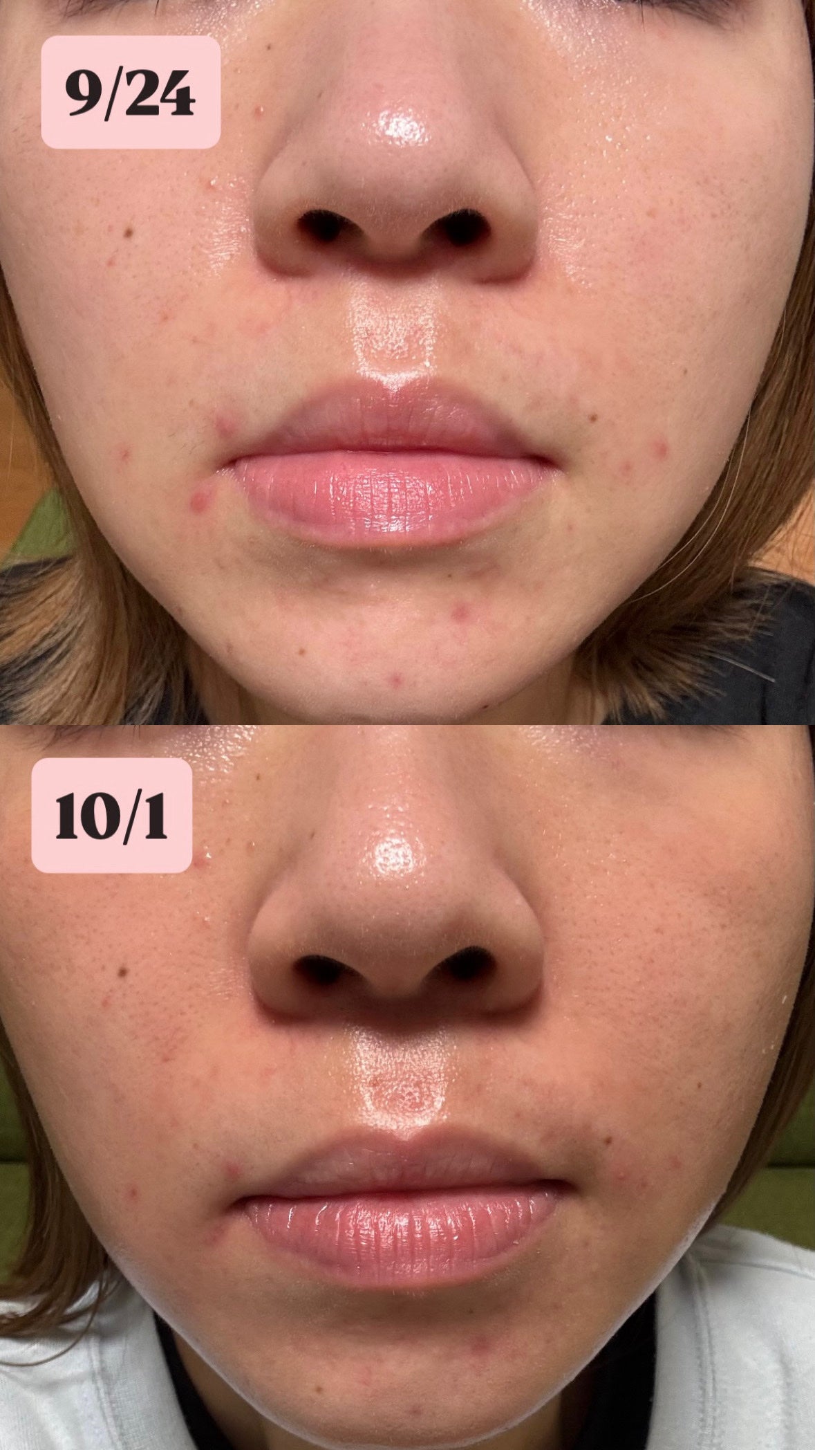 3セラミドパンテノールモイスチャーバリアクリーム/Anua/フェイスクリームを使ったクチコミ(1枚目)