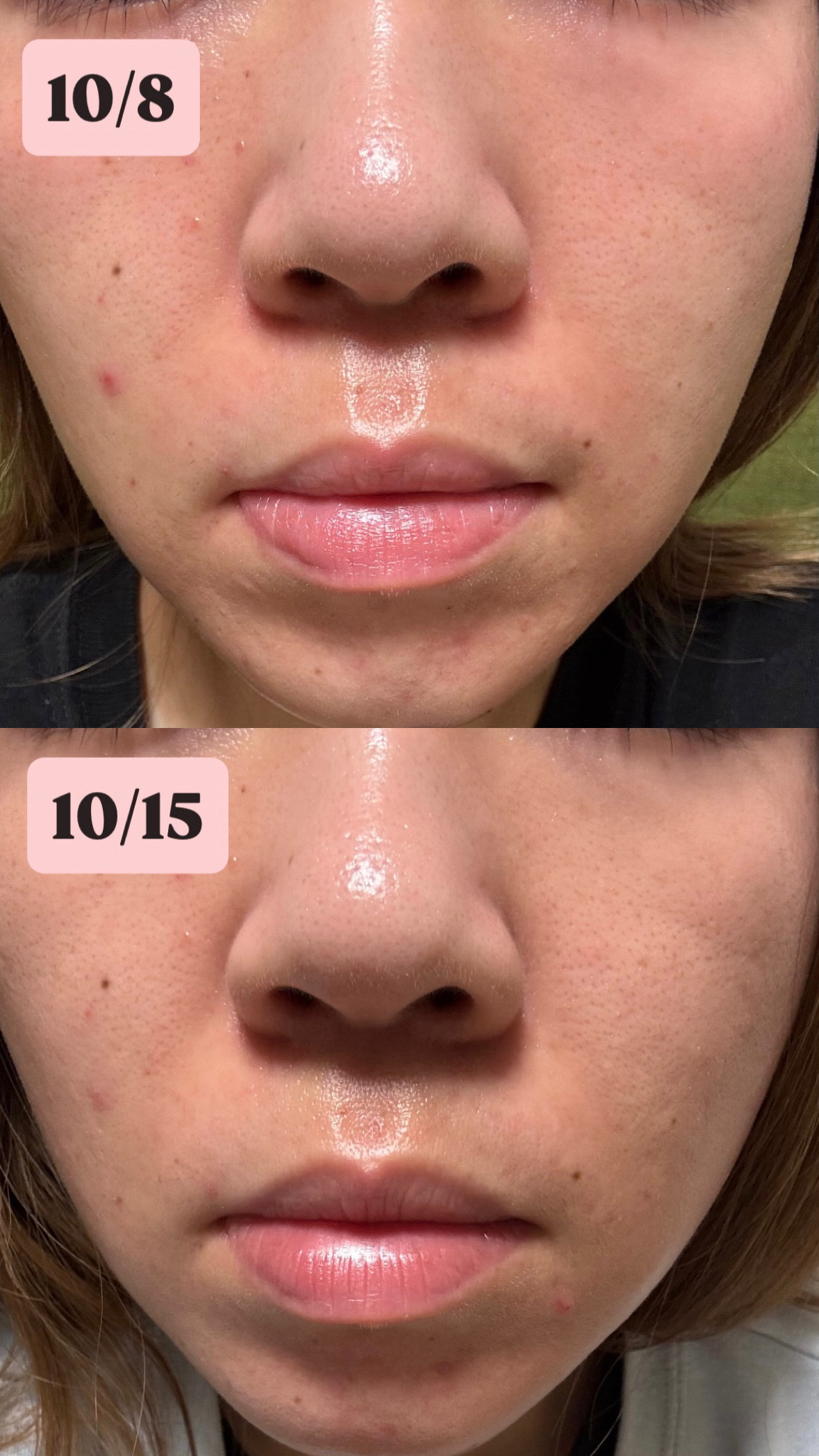 3セラミドパンテノールモイスチャーバリアクリーム/Anua/フェイスクリームを使ったクチコミ（2枚目）