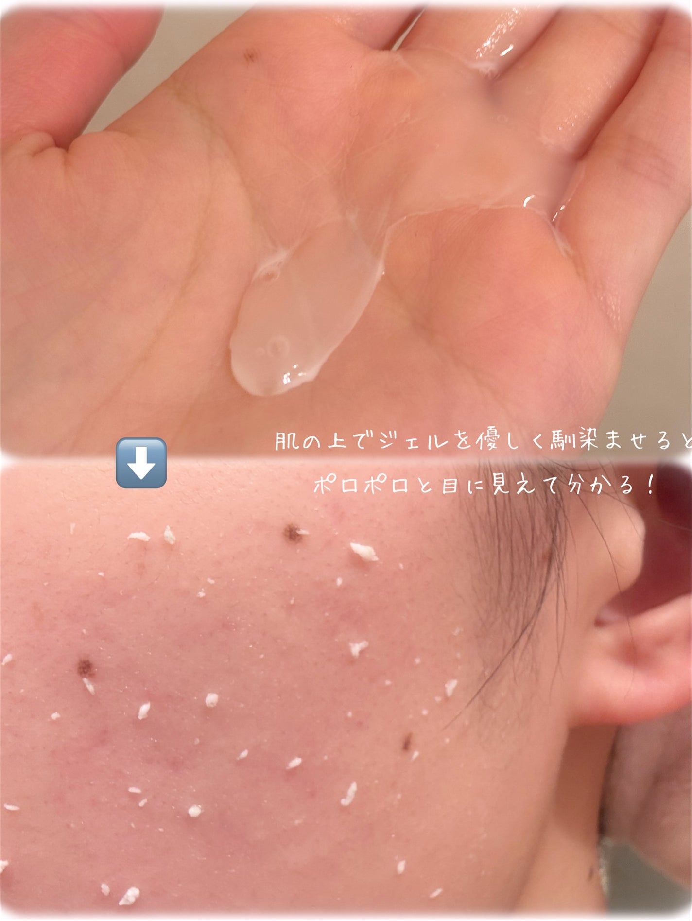 NIKIPITA 薬用GG角質クリアケアジェル/NIKI PITA/ピーリングを使ったクチコミ(3枚目)