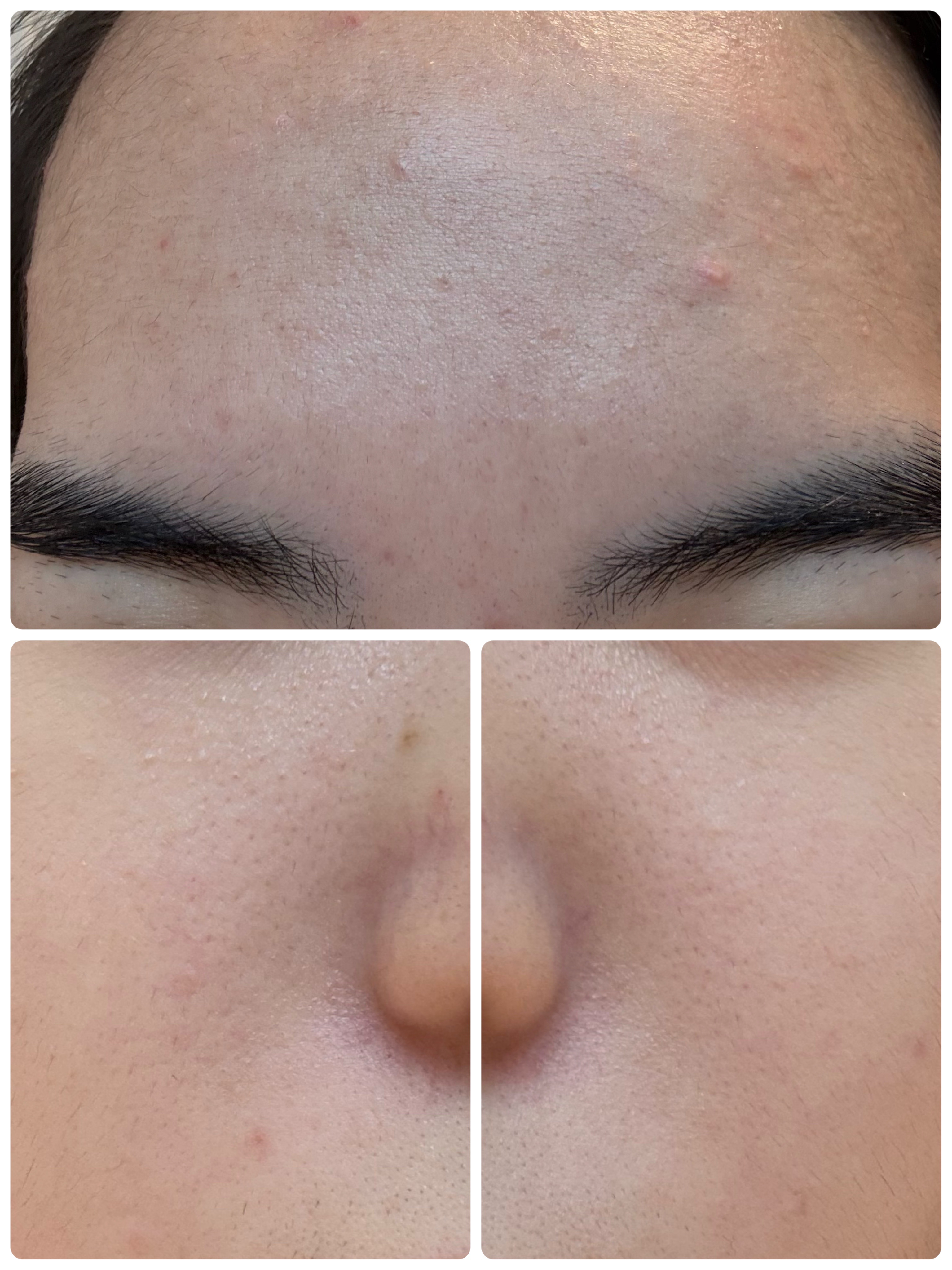 ブラックヘッドバームスクラブ/オブジェ/フェイスバームを使ったクチコミ（3枚目）