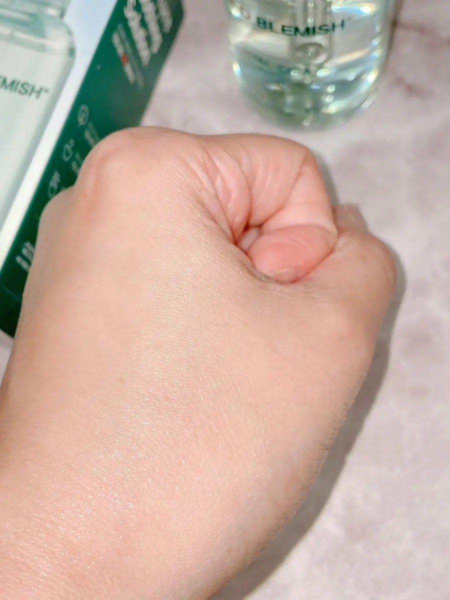 レッドブレミッシュ クリアヒアルシカスージングセラム/Dr.G/美容液を使ったクチコミ(3枚目)