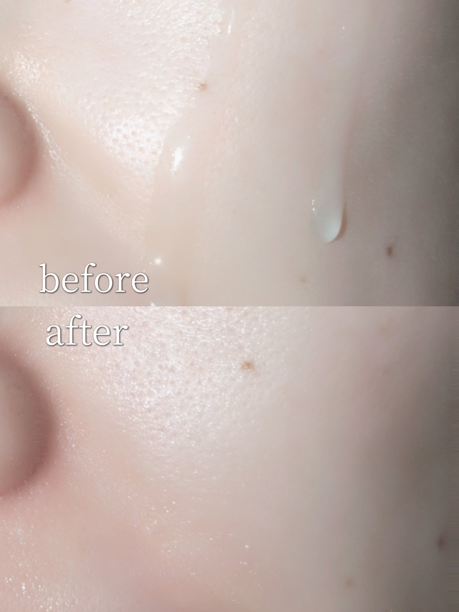 リソウ リペアビューティーエッセンス AP/リソウコーポレーション/美容液を使ったクチコミ（3枚目）