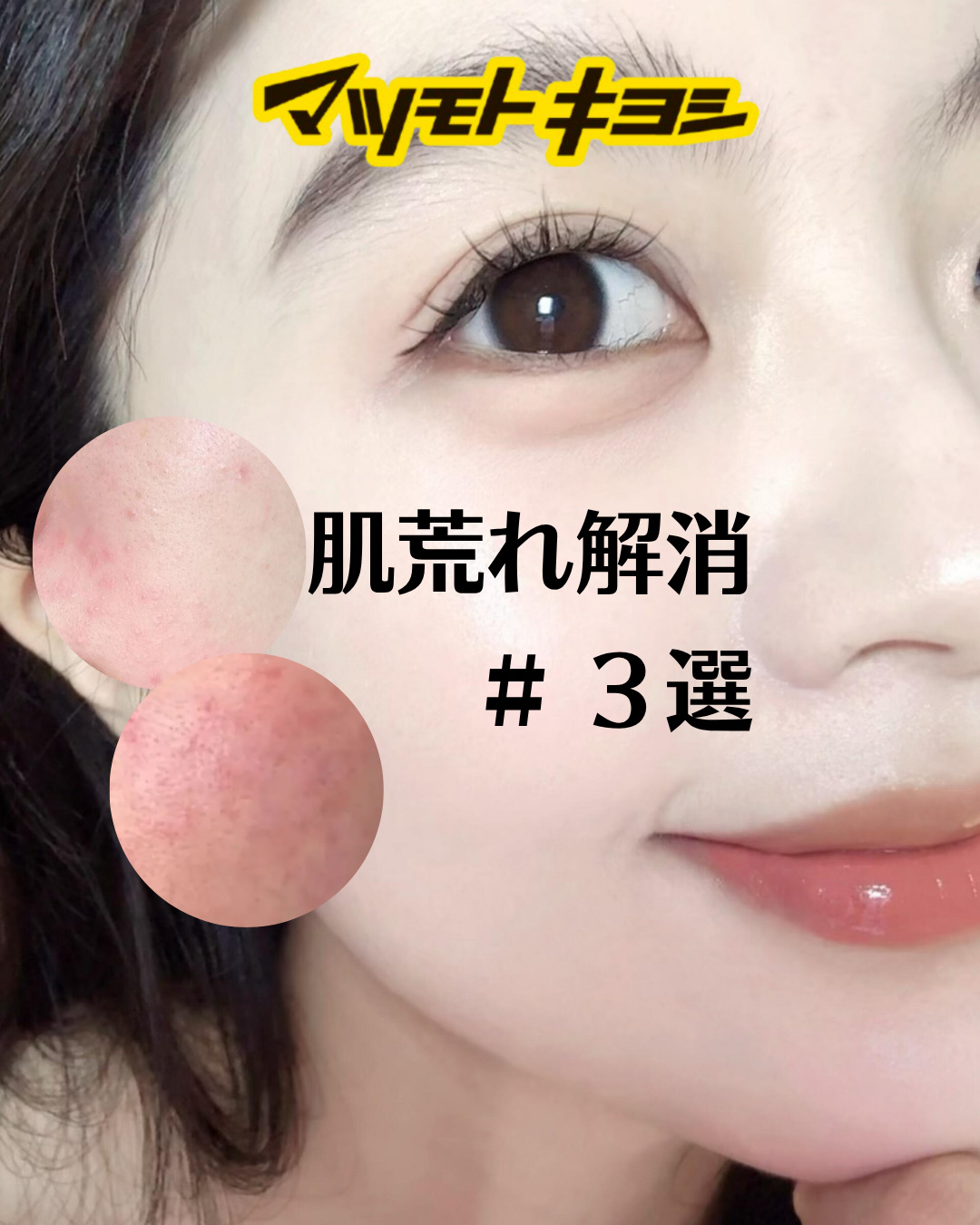 アネトス バランシング トリートメントクリーム/Anetos/フェイスクリームを使ったクチコミ（1枚目）