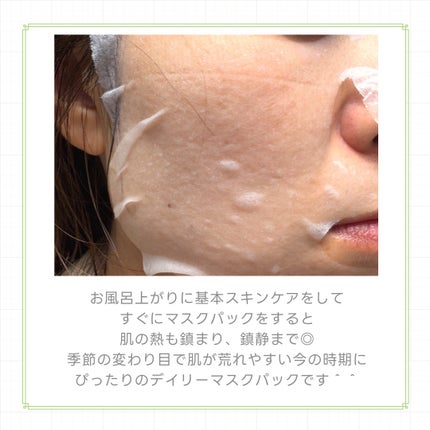 ドクダミシートマスクデイリーピック/Abib /シートマスク・パックを使ったクチコミ(5枚目)