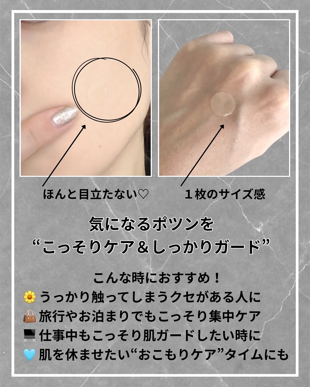 バンドエイド　顔用パッチ/バンドエイド/その他スキンケアを使ったクチコミ（3枚目）