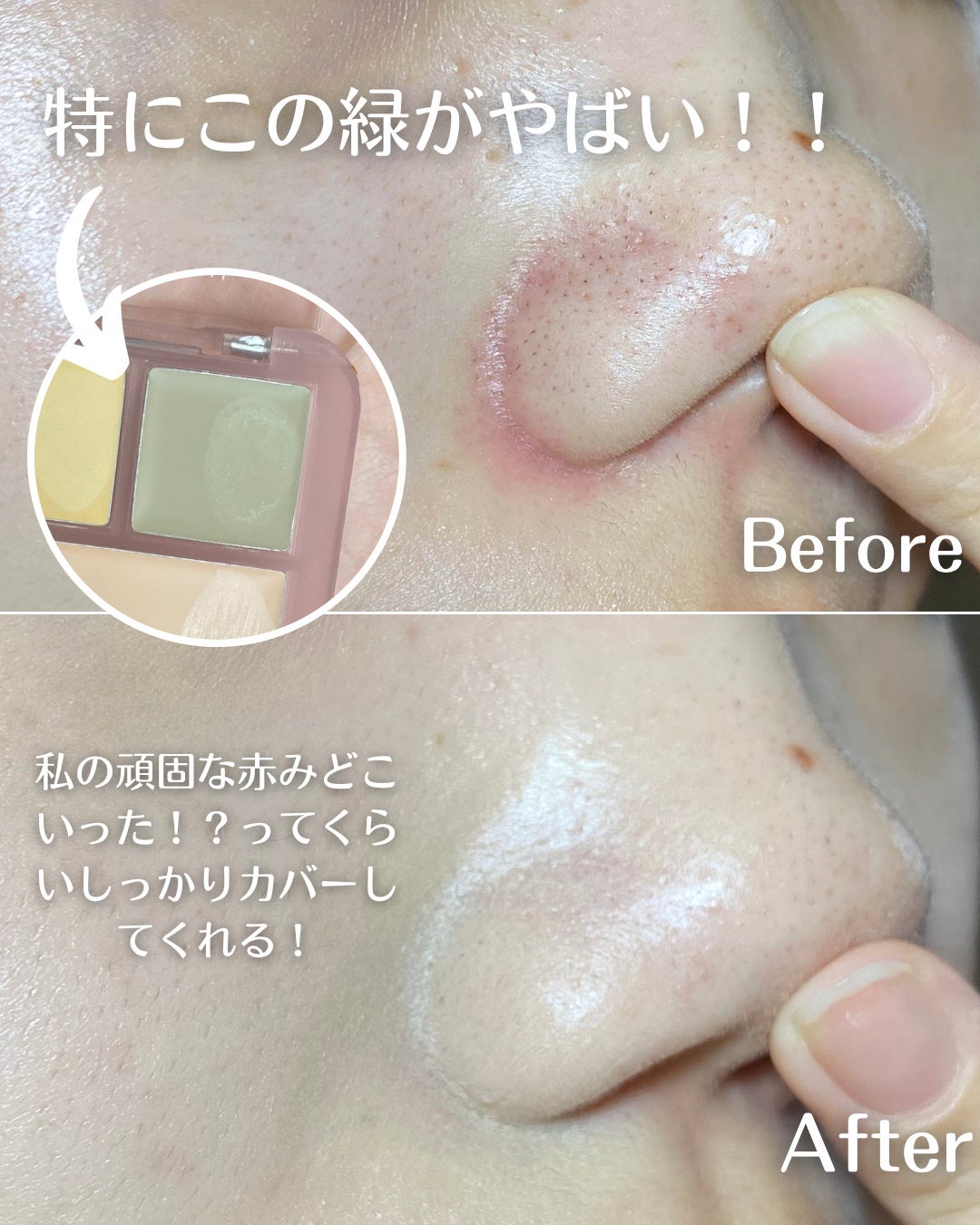 コンシールブレンダーパレット/LUNA/パレットコンシーラーを使ったクチコミ(6枚目)